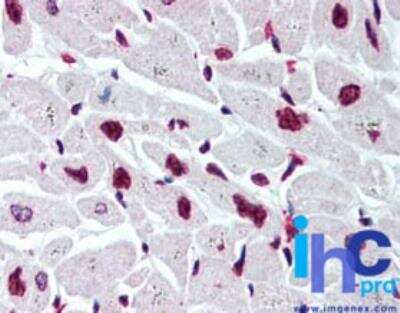 Immunohistochemistry-Paraffin: Histone H2B, member S Antibody [NB100-56347]
