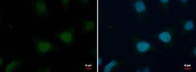 Immunocytochemistry/ Immunofluorescence: Histone H2B Antibody [NBP2-42854]