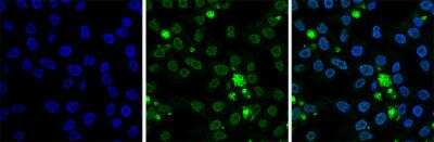 Immunocytochemistry/ Immunofluorescence: Histone H2B Antibody [NBP2-59270]