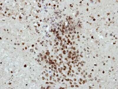 Immunohistochemistry-Paraffin: Histone H2B Antibody [NBP2-42854]