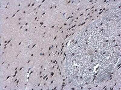 Immunohistochemistry-Paraffin: Histone H2B Antibody [NBP2-42854]