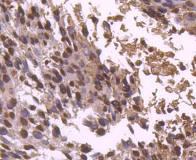 Immunohistochemistry-Paraffin: Histone H2B Antibody (SD20-63) [NBP2-67753]