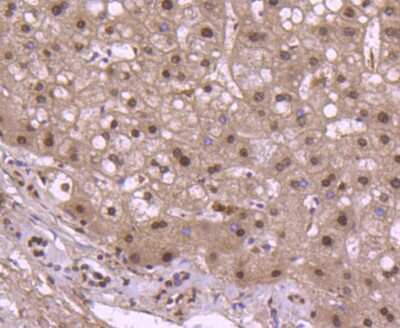 Immunohistochemistry-Paraffin: Histone H2B Antibody (SD20-63) [NBP2-67753]