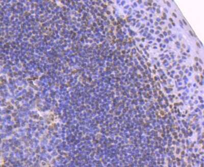 Immunohistochemistry-Paraffin: Histone H2B Antibody (SD20-63) [NBP2-67753]