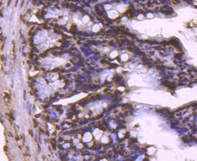 Immunohistochemistry-Paraffin: Histone H2B Antibody (SD20-63) [NBP2-67753]