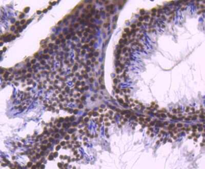 Immunohistochemistry-Paraffin: Histone H2B Antibody (SD20-63) [NBP2-67753]