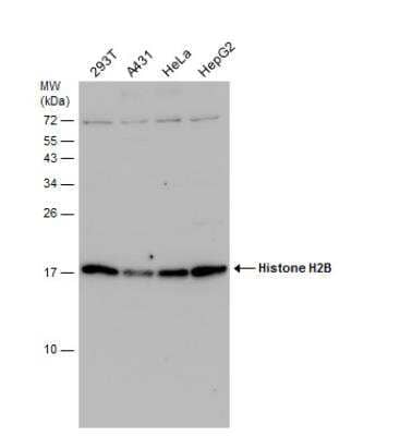 Western Blot: Histone H2B Antibody [NBP2-42854]