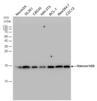 Western Blot: Histone H2B type 2E Antibody [NBP2-42855]