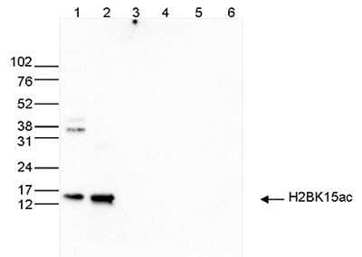 Western Blot: Histone H2B [ac Lys15] Antibody [NBP2-59272]