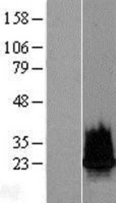 Western Blot: Histone H2B Overexpression Lysate [NBP2-11038]