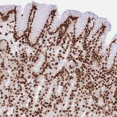 Immunohistochemistry-Paraffin: Histone H2B type 2E Antibody [NBP2-46688]