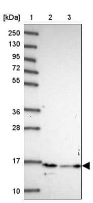 Western Blot: Histone H2B type 2E Antibody [NBP2-46688]