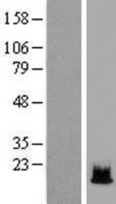 Western Blot: Histone H2B type 1B Overexpression Lysate [NBP2-06573]