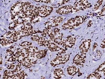 Immunohistochemistry-Paraffin: Histone H2B type 2E Antibody [NBP2-99782]