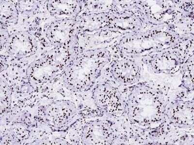 Immunohistochemistry-Paraffin: Histone H2B type 2E Antibody [NBP2-99782]