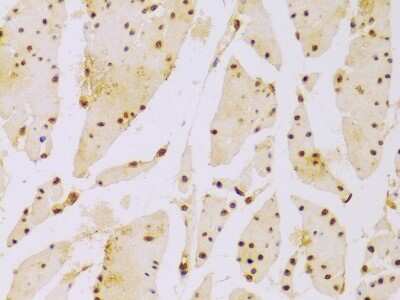Immunohistochemistry-Paraffin: Histone H2B type 2E Antibody - Azide and BSA Free [NBP3-03254]