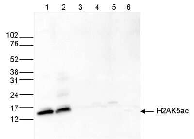 Western Blot: Histone H2a [ac Lys5] Antibody [NBP2-59261]