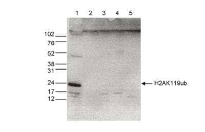 Western Blot: Histone H2a [ubiquitylated Lys119] Antibody [NBP2-62793]