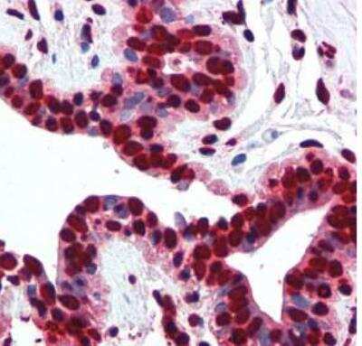 Immunohistochemistry-Paraffin: Histone H2a Antibody [NB100-56346]