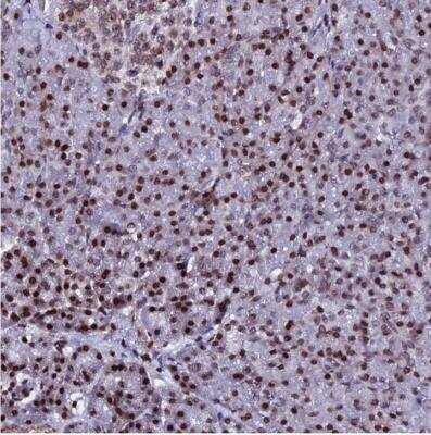 Immunohistochemistry-Paraffin: Histone H2AX Antibody [NBP2-54689]