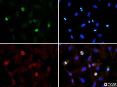 Immunocytochemistry/ Immunofluorescence: Histone H3 [Trimethyl Lys56] Antibody - BSA Free [NB21-1343]