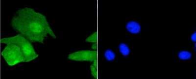 Immunocytochemistry/ Immunofluorescence: Histone H3.3 Antibody (ST50-08) [NBP2-67530]