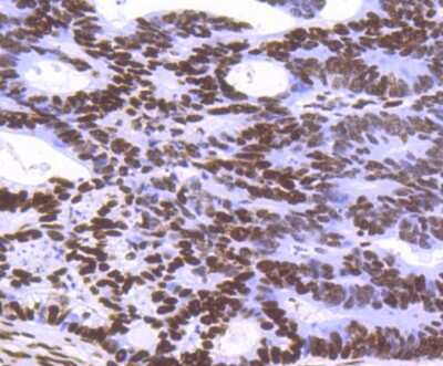 Immunohistochemistry-Paraffin: Histone H3.3 Antibody (ST50-08) [NBP2-67530]