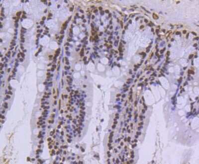 Immunohistochemistry-Paraffin: Histone H3.3 Antibody (ST50-08) [NBP2-67530]
