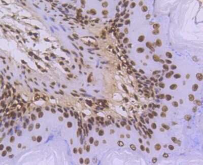 Immunohistochemistry-Paraffin: Histone H3.3 Antibody (ST50-08) [NBP2-67530]