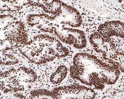 Immunohistochemistry-Paraffin: Histone H3.3 Antibody (ST50-08) [NBP2-67530]