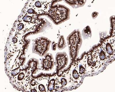 Immunohistochemistry-Paraffin: Histone H3.3 Antibody (ST50-08) [NBP2-67530]