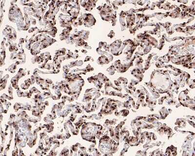 Immunohistochemistry-Paraffin: Histone H3.3 Antibody (ST50-08) [NBP2-67530]