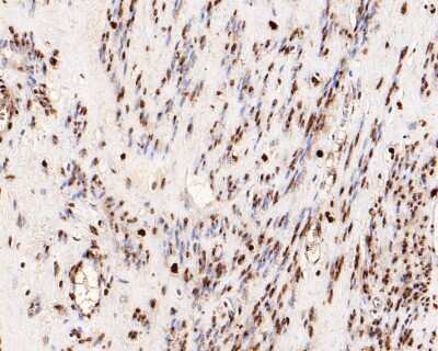 Immunohistochemistry-Paraffin: Histone H3.3 Antibody (ST50-08) [NBP2-67530]