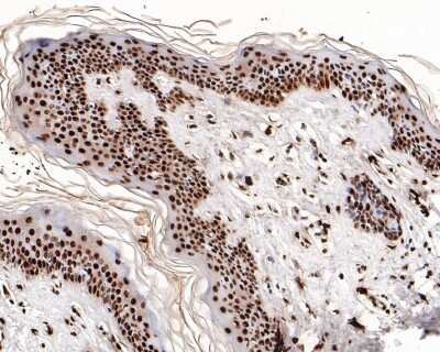 Immunohistochemistry-Paraffin: Histone H3.3 Antibody (ST50-08) [NBP2-67530]