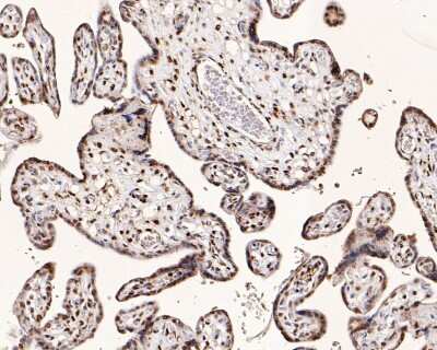 Immunohistochemistry-Paraffin: Histone H3.3 Antibody (ST50-08) [NBP2-67530]