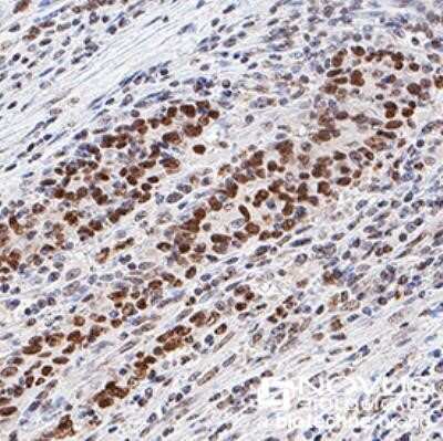Immunohistochemistry-Paraffin: Histone H3 [Trimethyl Lys9] Antibody (6F12-H4) - Azide and BSA Free [NBP2-80769]