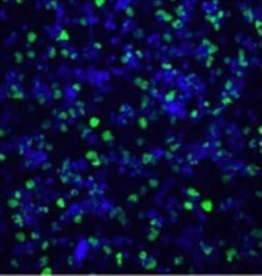 Immunocytochemistry/ Immunofluorescence: Histone H3 [Citrulline Arg17, Citrulline Arg2, Citrulline Arg8] Antibody [NB100-57135]