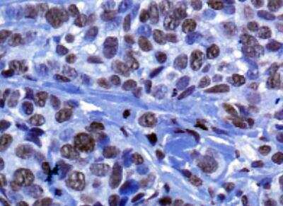 Immunohistochemistry: Histone H3 Antibody - BSA Free [NB500-171]