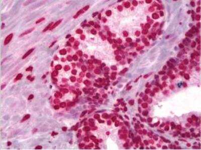 Immunohistochemistry-Paraffin: Histone H3 Antibody [NB100-747]