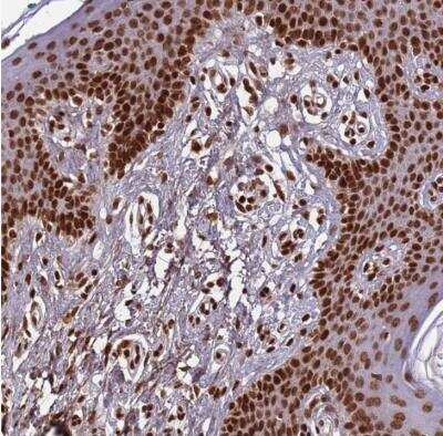 Immunohistochemistry-Paraffin: Histone H3 Antibody [NBP2-54701]