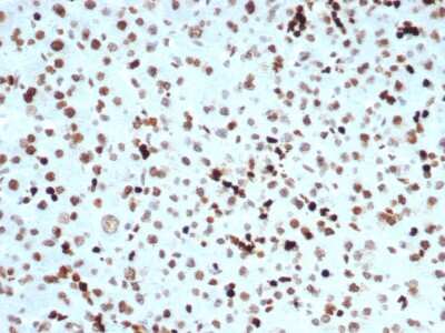 Immunohistochemistry-Paraffin: Histone H3 [p Ser10] Antibody (PHH3/471R) - Azide and BSA Free [NBP3-08511]