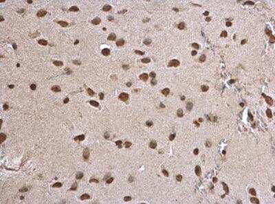 Immunohistochemistry-Paraffin: Histone H3.3 Antibody [NBP2-14981]