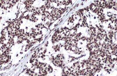 Immunohistochemistry-Paraffin: Histone H3.3 Antibody [NBP2-14981]