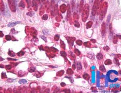 Immunohistochemistry-Paraffin: Histone H3.3 Antibody [NBP2-24697]