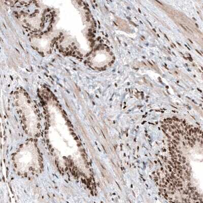 Immunohistochemistry: HIST1H3A Antibody (CL4968) [NBP2-61643]
