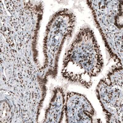 Immunohistochemistry: HIST1H3A Antibody (CL4968) [NBP2-61643]