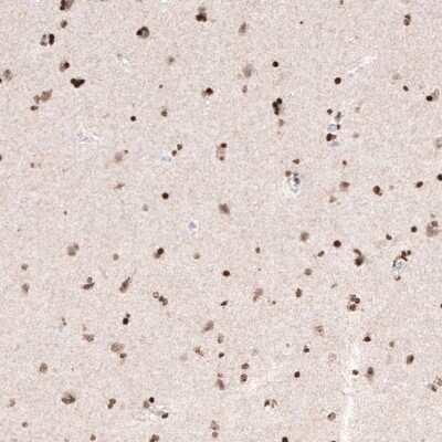 Immunohistochemistry: HIST1H3A Antibody (CL4968) [NBP2-61643]