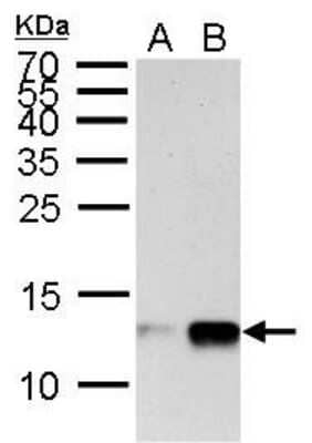 Western Blot: Histone H4 [Monomethyl Lys20] Antibody [NBP2-42859]