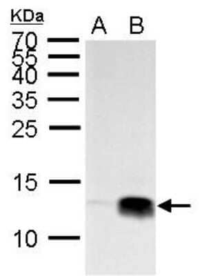 Western Blot: Histone H4 [Trimethyl Lys20] Antibody [NBP2-42862]