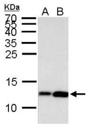 Western Blot: Histone H4 [ac Lys8] Antibody [NBP2-42863]